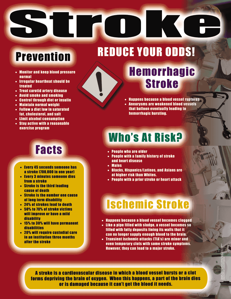Stroke - Health Issues Poster & Handout
