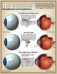 Nearsightedness & Farsightedness